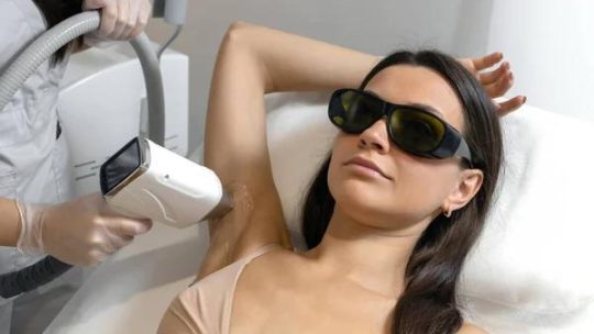 Épilation laser : est-ce vraiment définitif ?