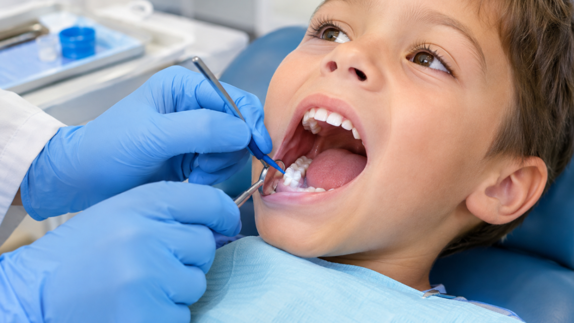 Le scellement des sillons pour prévenir les caries chez l&rsquo;enfant