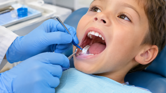Le scellement des sillons pour prévenir les caries chez l&rsquo;enfant